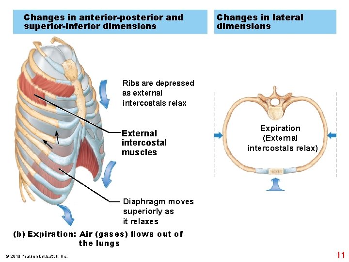 Changes in anterior-posterior and superior-inferior dimensions Changes in lateral dimensions Ribs are depressed as