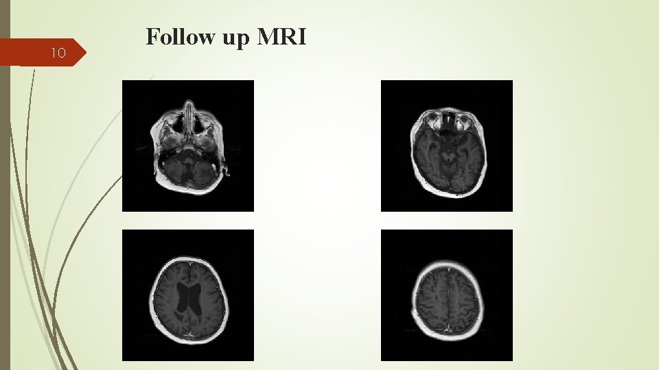 10 Follow up MRI 