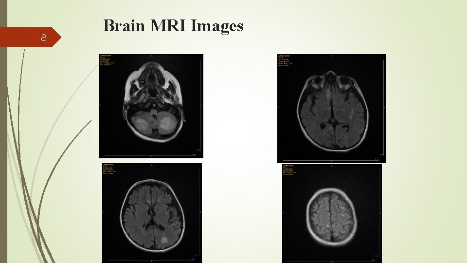 8 Brain MRI Images 