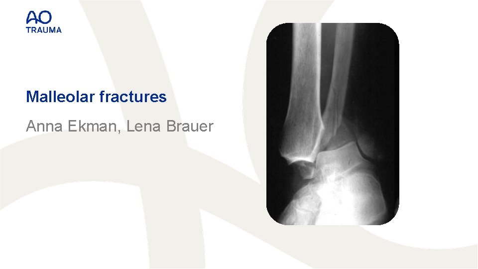 Malleolar fractures Anna Ekman, Lena Brauer 