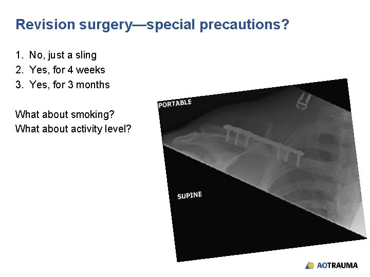 Revision surgery—special precautions? 1. No, just a sling 2. Yes, for 4 weeks 3.
