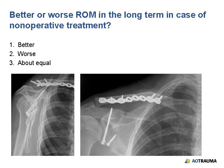 Better or worse ROM in the long term in case of nonoperative treatment? 1.