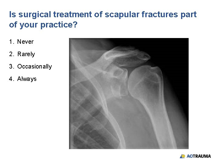 Is surgical treatment of scapular fractures part of your practice? 1. Never 2. Rarely