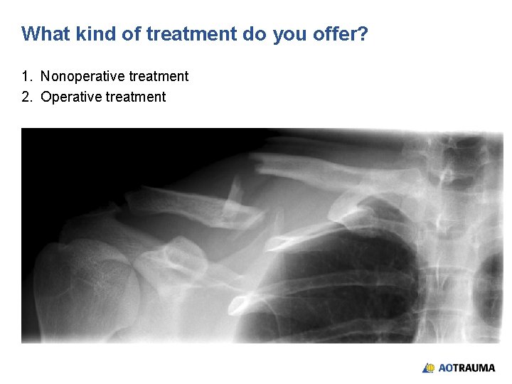 What kind of treatment do you offer? 1. Nonoperative treatment 2. Operative treatment 