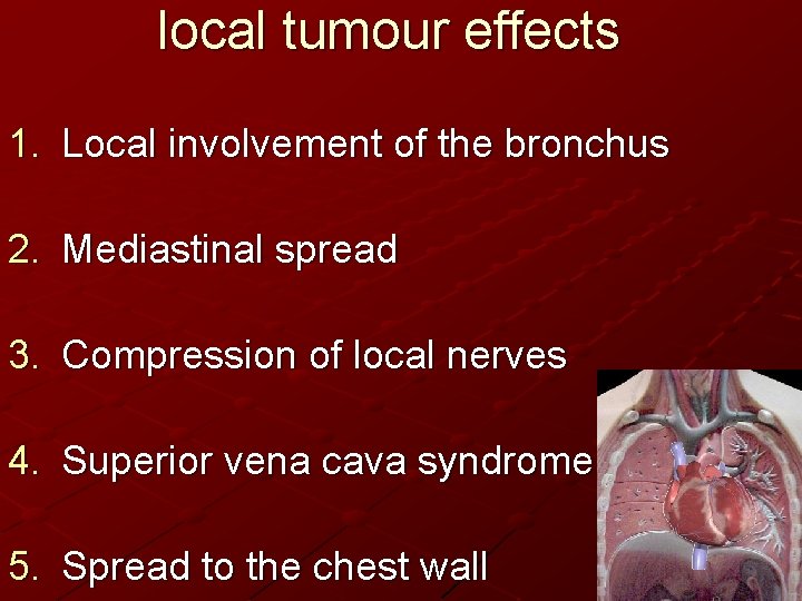 local tumour effects 1. Local involvement of the bronchus 2. Mediastinal spread 3. Compression