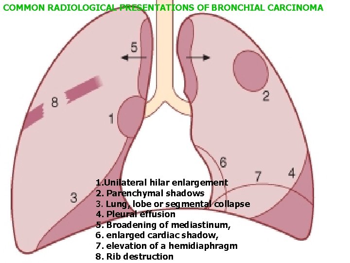 COMMON RADIOLOGICAL PRESENTATIONS OF BRONCHIAL CARCINOMA 1. Unilateral hilar enlargement 2. Parenchymal shadows 3.