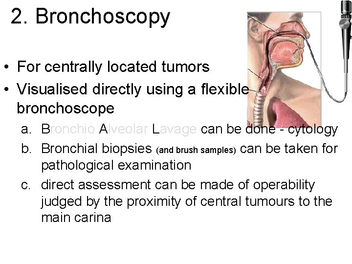 2. Bronchoscopy • For centrally located tumors • Visualised directly using a flexible bronchoscope