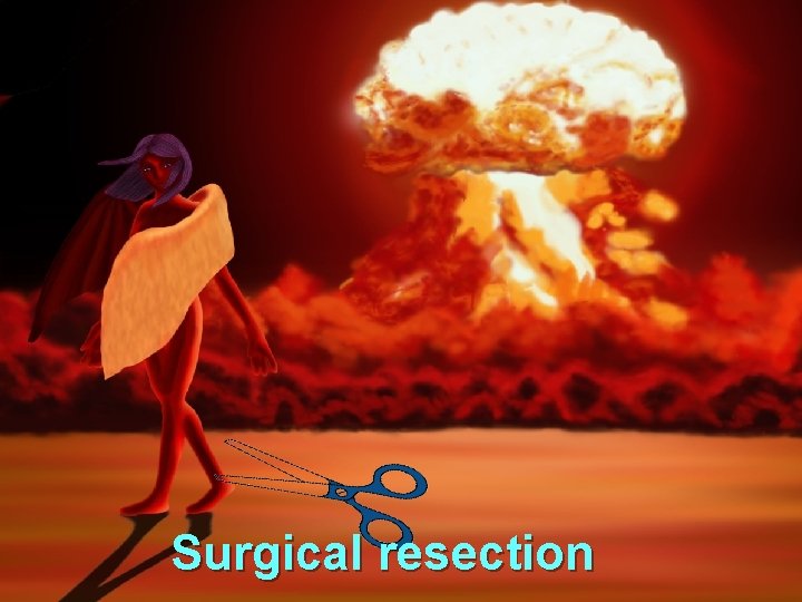 Surgical resection 