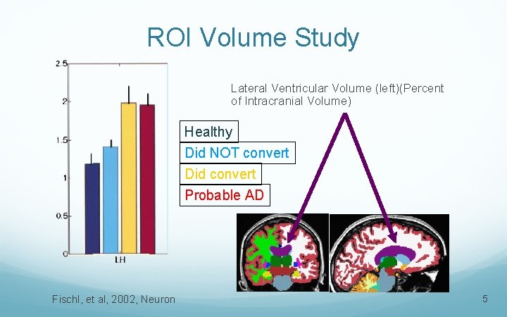 ROI Volume Study Lateral Ventricular Volume (left)(Percent of Intracranial Volume) Healthy Did NOT convert