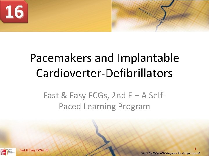 16 Pacemakers and Implantable Cardioverter Defibrillators Fast & Easy ECGs, 2 nd E –