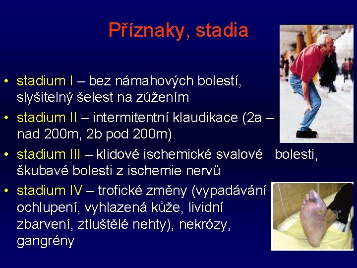 Příznaky, stadia • stadium I – bez námahových bolestí, slyšitelný šelest na zúžením •