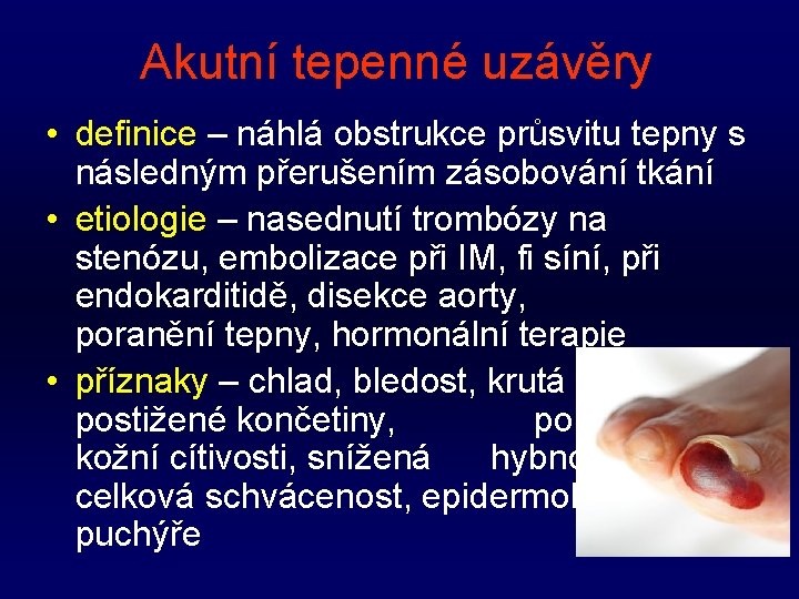 Akutní tepenné uzávěry • definice – náhlá obstrukce průsvitu tepny s následným přerušením zásobování