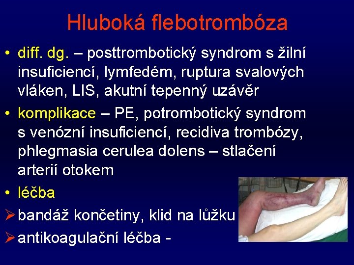 Hluboká flebotrombóza • diff. dg. – posttrombotický syndrom s žilní insuficiencí, lymfedém, ruptura svalových