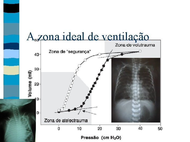 A zona ideal de ventilação 