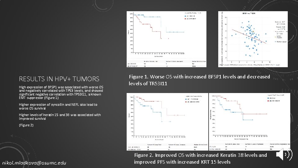 RESULTS IN HPV+ TUMORS High expression of BFSP 1 was associated with worse OS