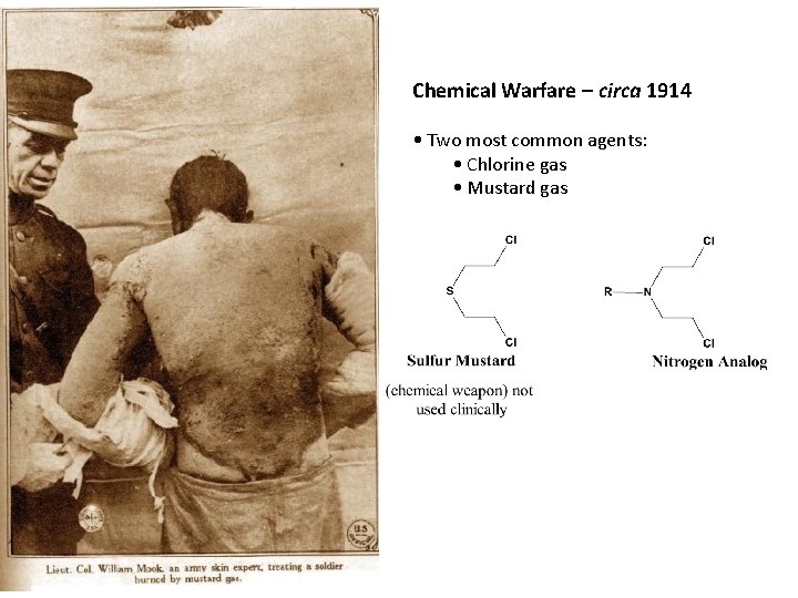 Chemical Warfare – circa 1914 • Two most common agents: • Chlorine gas •