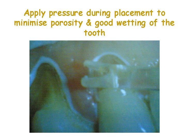 Apply pressure during placement to minimise porosity & good wetting of the tooth 