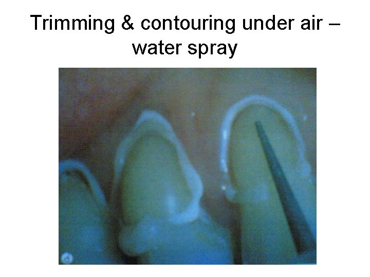 Trimming & contouring under air – water spray Trimming & contouring under air – water spray