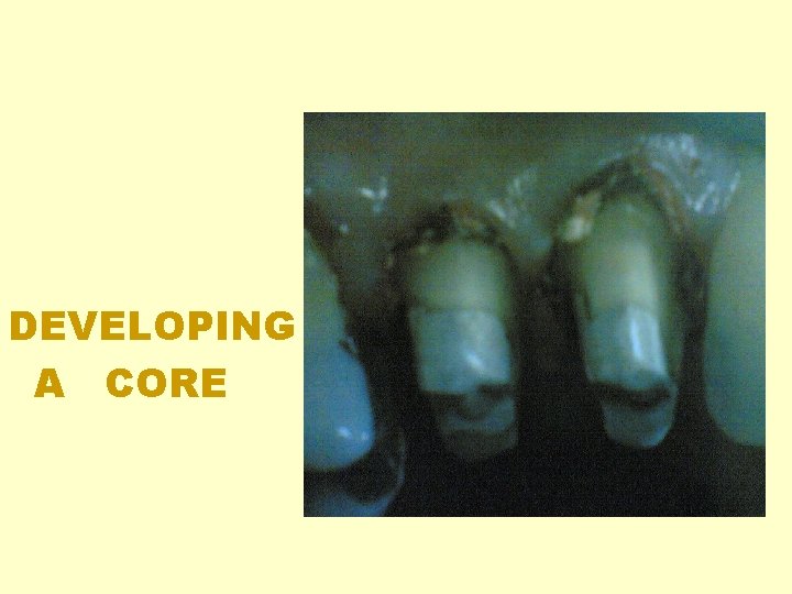 DEVELOPING A CORE DEVELOPING A CORE