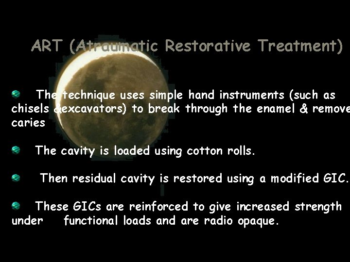 ART (Atraumatic Restorative Treatment) The technique uses simple hand instruments (such as chisels &excavators) ART (Atraumatic Restorative Treatment) The technique uses simple hand instruments (such as chisels &excavators)