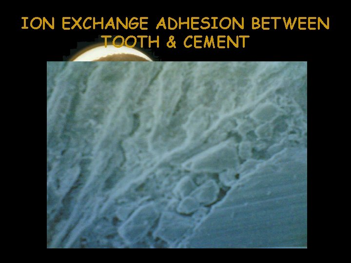 ION EXCHANGE ADHESION BETWEEN TOOTH & CEMENT 