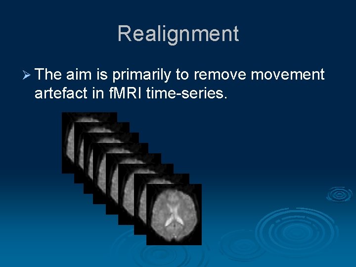 Realignment Ø The aim is primarily to removement artefact in f. MRI time-series. 