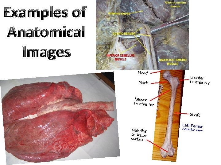 Examples of Anatomical Images Examples of Anatomical Images