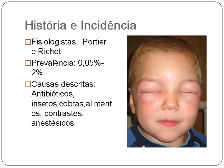 História e Incidência �Fisiologistas : Portier e Richet �Prevalência: 0, 05%2% �Causas descritas: Antibióticos,