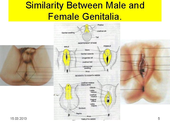 Similarity Between Male and Female Genitalia. 15. 03. 2013 Biology of human sexuality 5 Similarity Between Male and Female Genitalia. 15. 03. 2013 Biology of human sexuality 5