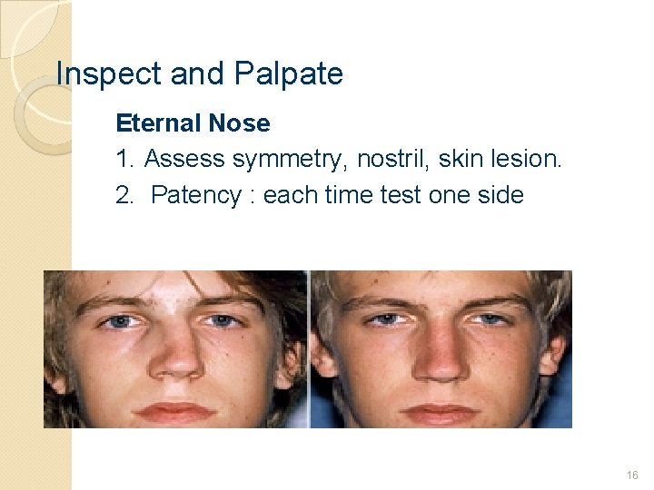 Inspect and Palpate Eternal Nose 1. Assess symmetry, nostril, skin lesion. 2. Patency :