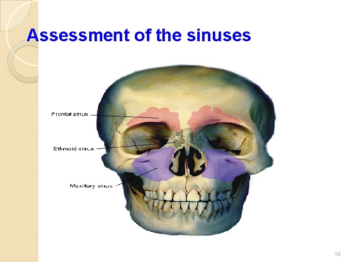 Assessment of the sinuses 18 