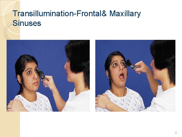 Transillumination-Frontal& Maxillary Sinuses 21 