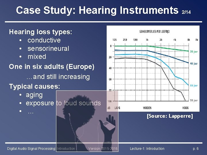 Case Study: Hearing Instruments 2/14 Hearing loss types: • conductive • sensorineural • mixed