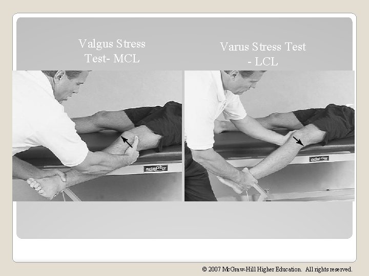 Valgus Stress Test- MCL Varus Stress Test - LCL © 2007 Mc. Graw-Hill Higher