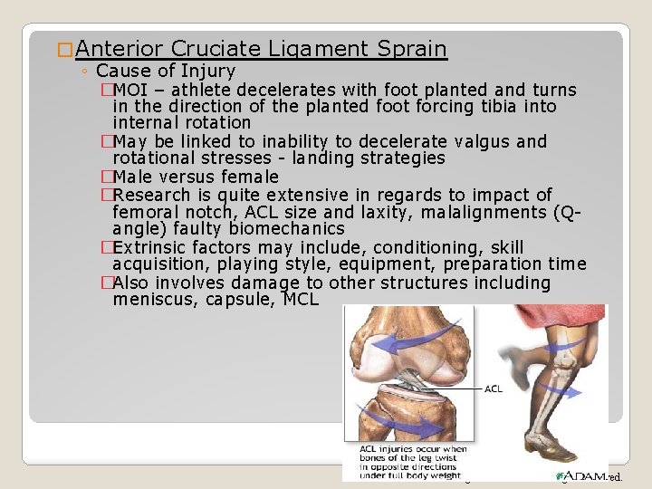 � Anterior Cruciate Ligament Sprain ◦ Cause of Injury �MOI – athlete decelerates with