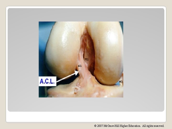 © 2007 Mc. Graw-Hill Higher Education. All rights reserved. 