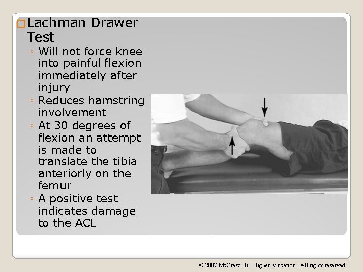 �Lachman Test Drawer ◦ Will not force knee into painful flexion immediately after injury