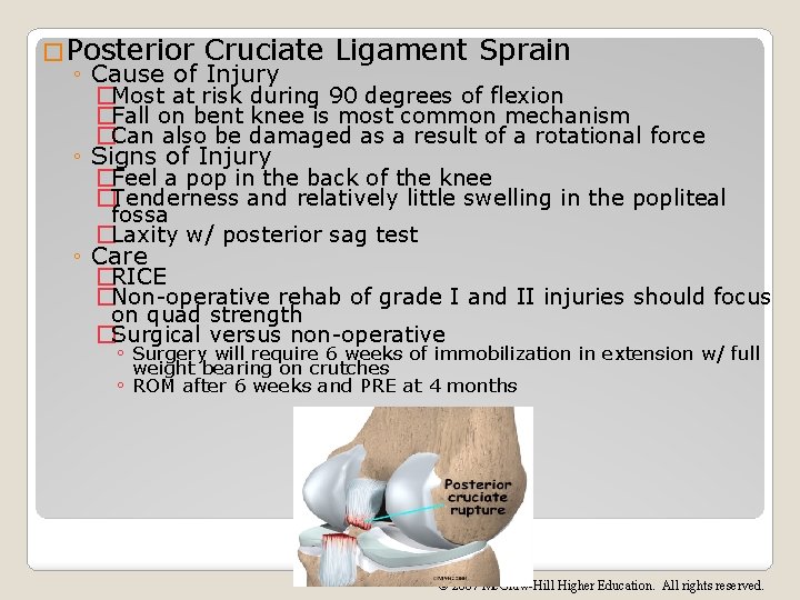 �Posterior Cruciate Ligament Sprain ◦ Cause of Injury �Most at risk during 90 degrees