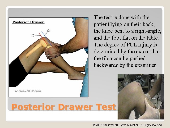 The test is done with the patient lying on their back, the knee bent