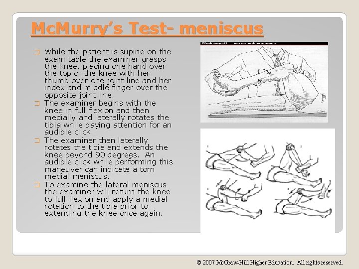 Mc. Murry’s Test- meniscus While the patient is supine on the exam table the