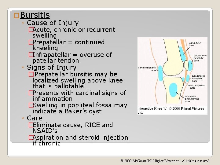 �Bursitis ◦ Cause of Injury �Acute, chronic or recurrent swelling �Prepatellar = continued kneeling