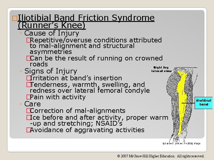 �Iliotibial Band Friction Syndrome (Runner’s Knee) ◦ Cause of Injury �Repetitive/overuse conditions attributed to