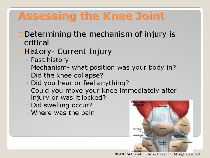 Assessing the Knee Joint �Determining the mechanism of injury is critical �History- Current Injury