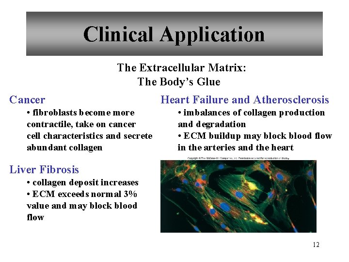 Clinical Application The Extracellular Matrix: The Body’s Glue Cancer • fibroblasts become more contractile,