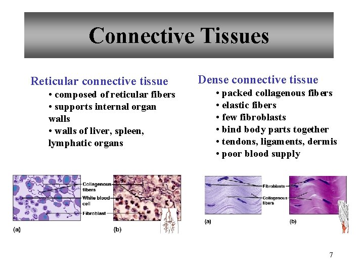 Connective Tissues Reticular connective tissue • composed of reticular fibers • supports internal organ