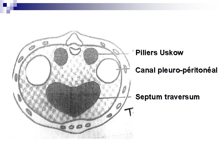 Piliers Uskow Canal pleuro-péritonéal Septum traversum 