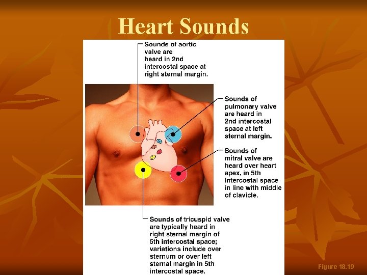 Heart Sounds Figure 18. 19 