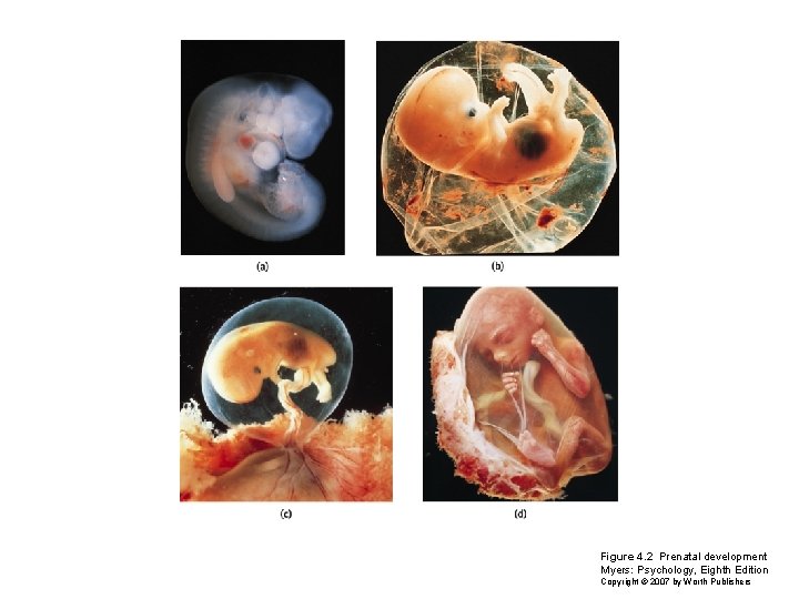 Figure 4. 2 Prenatal development Myers: Psychology, Eighth Edition Copyright © 2007 by Worth