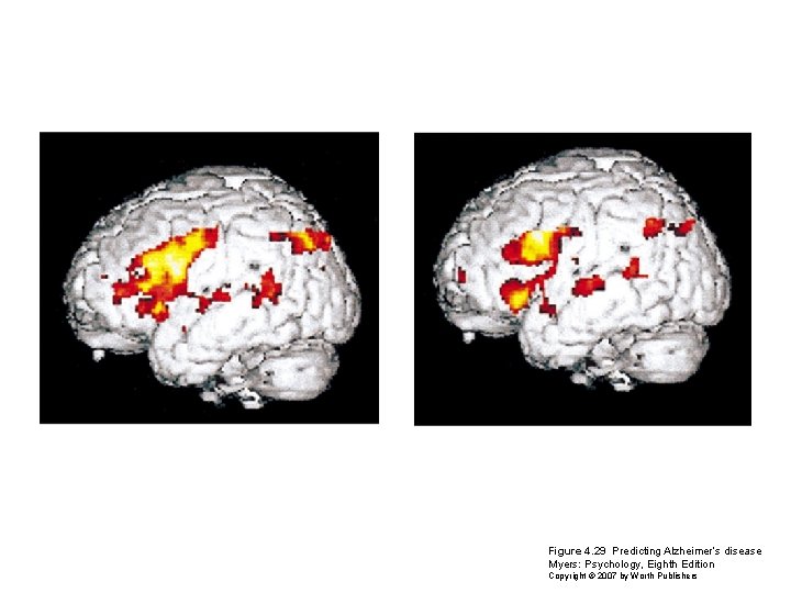 Figure 4. 29 Predicting Alzheimer’s disease Myers: Psychology, Eighth Edition Copyright © 2007 by