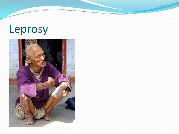 Leprosy 